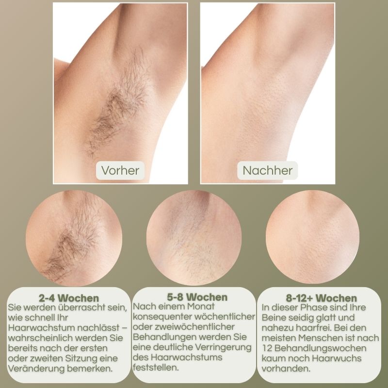 PureBella-IPL Haarentferner