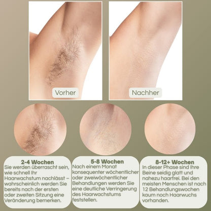 PureBella-IPL Haarentferner