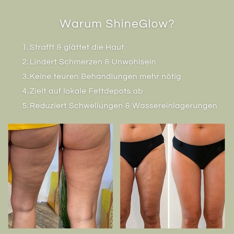 ShineGlow-Cellulite-Massagegerät