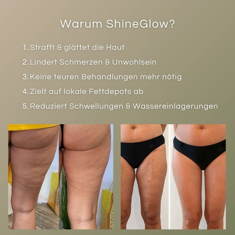 ShineGlow-Cellulite-Massagegerät