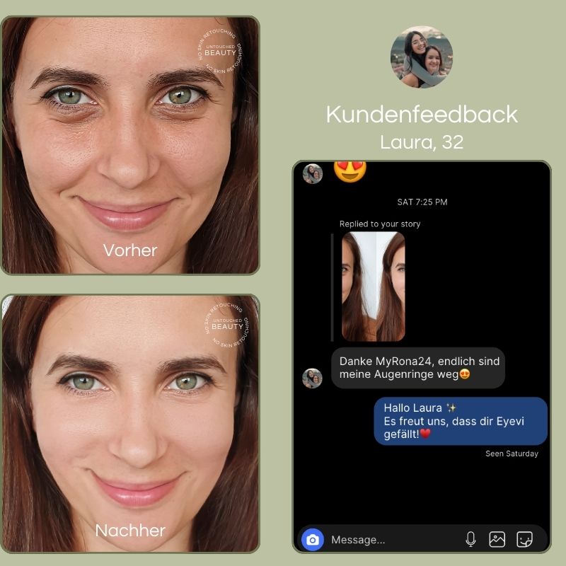 Eyevi - LED-Augenpads für Lift & Glow